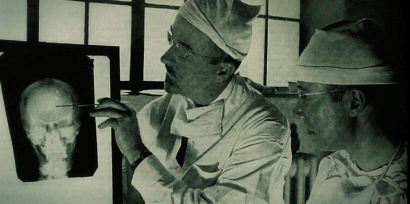 Dr. Walter Freeman (til venstre) og Dr. James W. Watts studerer et røntgenbilde av skallen til en pasient før en lobotomioperasjon. Bilde: Harris Ewing, i Saturday Evening Post, 24. mai 1941. Ingen opphavsrett/wikimedia Commons